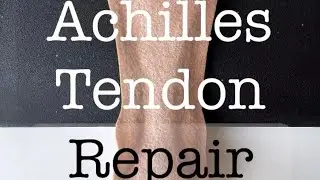Felt Surgery 🔪🪡 - Open Achilles Tendon Repair🦵🏼