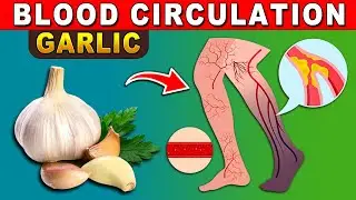 SHOCK! 12 foods that help improve blood circulation to the legs, Prevent clogged arteries! Daily Joy