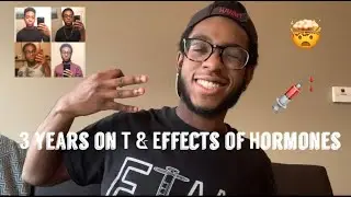 3 YEARS ON T TIMELINE & EFFECTS OF TESTOSTERONE // KEVIN DANIEL FTM