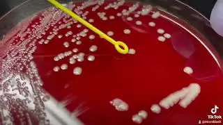 🦠Moraxella catarrhalis en placa de petri. 🧫👩‍🔬