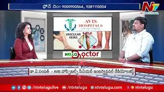 వెరికోజ్⁭వెయిన్స్ అంటే ఏంటి.. అధిక బరువు ప్రధాన కారణమా..? l Avis Hospitals l Hello Doctor l Ntv