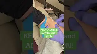 How I do painless IVs
