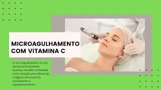 Protocolo- Microagulhamento com Vitamina C- Clareamento e Rejuvenescimento