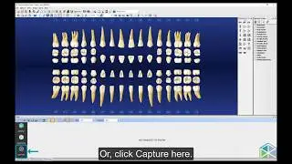 DTX Studio™ Clinic software works with your Patient management software - Dentrix