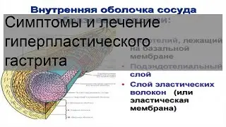 Симптомы и лечение гиперпластического гастрита