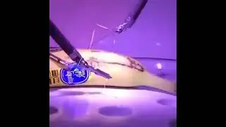 This remote surgery was made by a London surgeon on a BANANA in California, using 5G