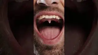 What's that at the end of your mouth? 😮👀 
