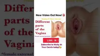 Female External Genitalia labeled properly! 