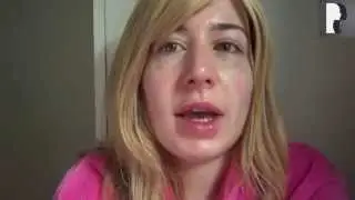 UPDATE! Revision Rhinoplasty Video Diary - Day 15 After Surgery