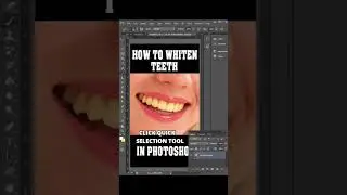 How To Whiten Teeth Quickly In Photoshop | 