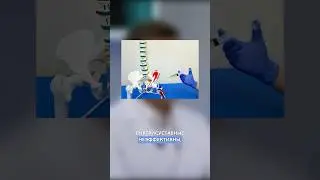 Какой вред может примести укол в сустав. Укол гилауроновой кислоты в сустав 