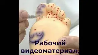 Су Джок терапия - видеоматериал о сути метода.