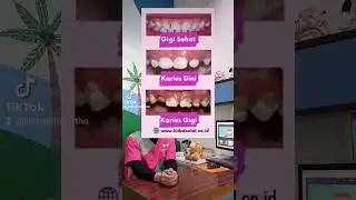 Gigi Anak Bercak Keputihan kenapa ya? #edukasi #dentist #edukasigigi #parentinginfo #doktergigianak