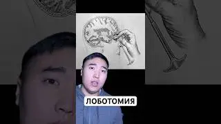 Lobotomy