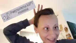 У нас прибавление / Результаты МРТ Головы