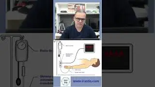 Como funciona o sistema de pressão arterial invasiva - PAI?