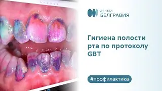 😁 Гигиена полости рта по Швейцарскому протоколу GBT