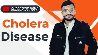 Cholera ( Vibrio cholerae ) pathophysiology, Risk Factor, Symptoms, complications, Test & diagnosis
