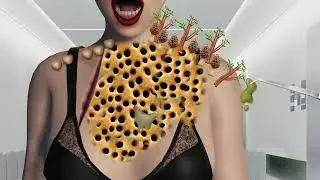 ASMR