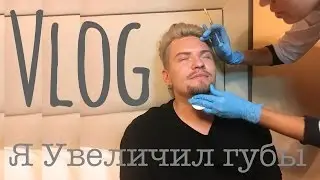 IN REAL LIFE / Я УВЕЛИЧИЛ ГУБЫ/ ЧТО МЫ ЖРАЛИ В КИЕВЕ?/ VLOG