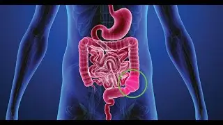 The Basics: Constipation | WebMD