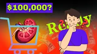 How much is your 1 KIDNEY worth?❗