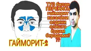 ГАЙМОРИТНИ УЙ ШАРОИТИДА ДАВОЛАШ ВА ОЛДИНИ ОЛИШ ЮЛЛАРИ.