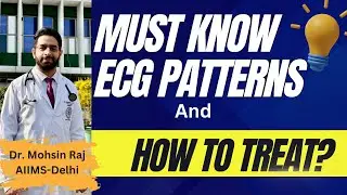 Cardiac Emergency: Decoding Dangerous ECG Tracings #ecg