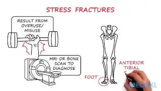 Orthopedics - Bone or Joint Injury: By Shalini Ramasunder M.D.