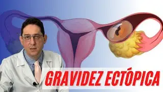 GRAVIDEZ ECTÓPICA