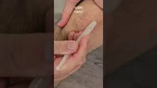 Narben behandeln