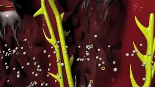 CCBs for Hypertension (high blood pressure) or Arrhythmias (irregular heartbeat)