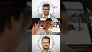 This Result Changed Everything 😍 | 5 Month Hair Transplant | Hairfree & Hairgrow Bangladesh