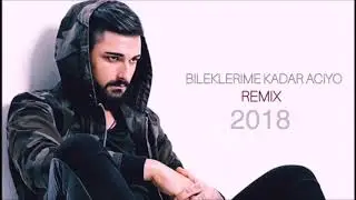 İdo Tatlıses - Bileklerime Kadar Acıyo (Remix)