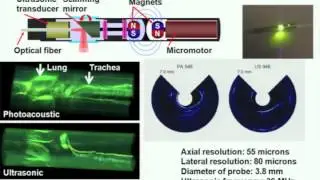 Photoacoustic tomography: ultrasonically breaking through the optical diffusion limit