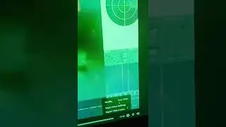 REMOTE NEURAL MONITORING
