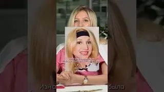 Ринопластика Орбакайте. Красиво же? 