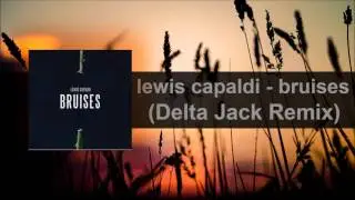 Lewis Capaldi - Bruises (Delta Jack Remix) [World Of Sound Promotion]