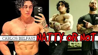 Carlos "Mogging Cbum" Belcast || Natty Or Not