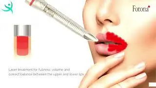 How to Achieve Fuller Lips?