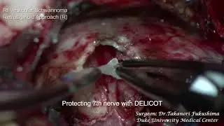 Delicot® Microsurgical Pattie Uses - Dr. Takanori Fukushima