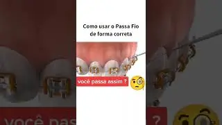 você usa fio dental? 