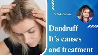 Dandruff - Causes, Symptoms, Treatment | Patient education I MIC
