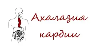 Ахалазия кардии