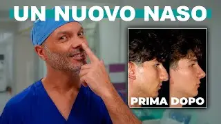 Rinoplastica e Otoplastica: Intervento Combinato (Vlog 01) | Dott. Dario Rochira
