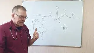 Электрокардиография. Методика, техника, происхождение и характеристика основных элементов ЭКГ.