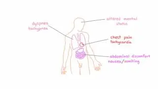 Signs and symptoms of hypoxemia