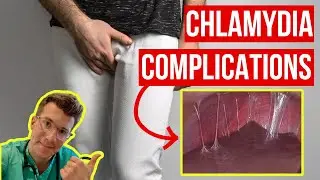 Doctor explains COMPLICATIONS of untreated CHLAMYDIA (STI) ...