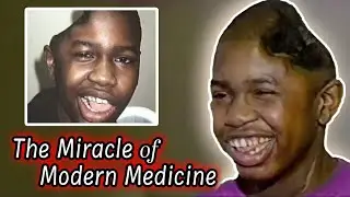 He Survived a Head Shot From a 357 Magnum Revolver