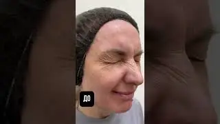 НЕ ДЕЛАЙ БОТОКС, АТО СТАНЕШЬ МОЛОДОЙ ✨